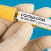 Борзнянський район: експрес-тест показав позитивний результат на інфікування коронавірусом
